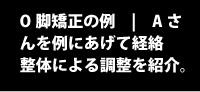 O脚調整の例 | 新潟市在住Aさんを例にあげて新潟市ぜん整体院の技術説明