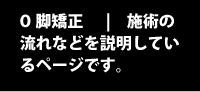 O脚矯正 | 施術の流れなどを説明
