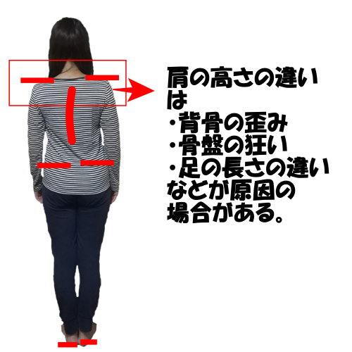 肩の違いは全身の歪みが原因